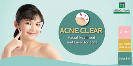 Acne facial