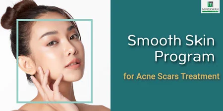 Fractional CO2 Laser