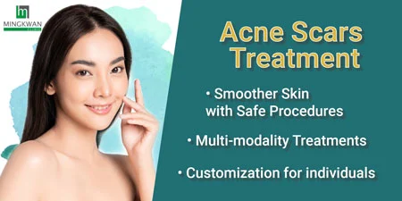 Acne scar treatment Bangkok