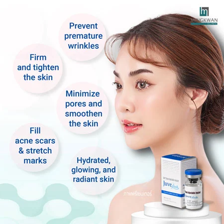 Juvelook collagen biostimulator benefits