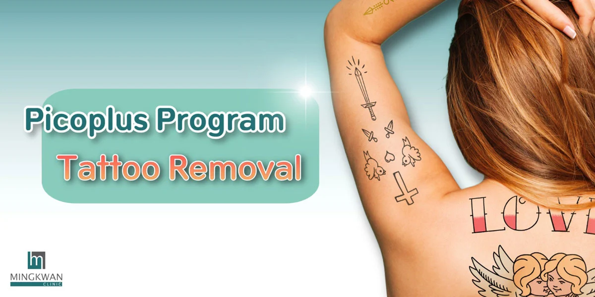 Tattoo removal picosecond laser