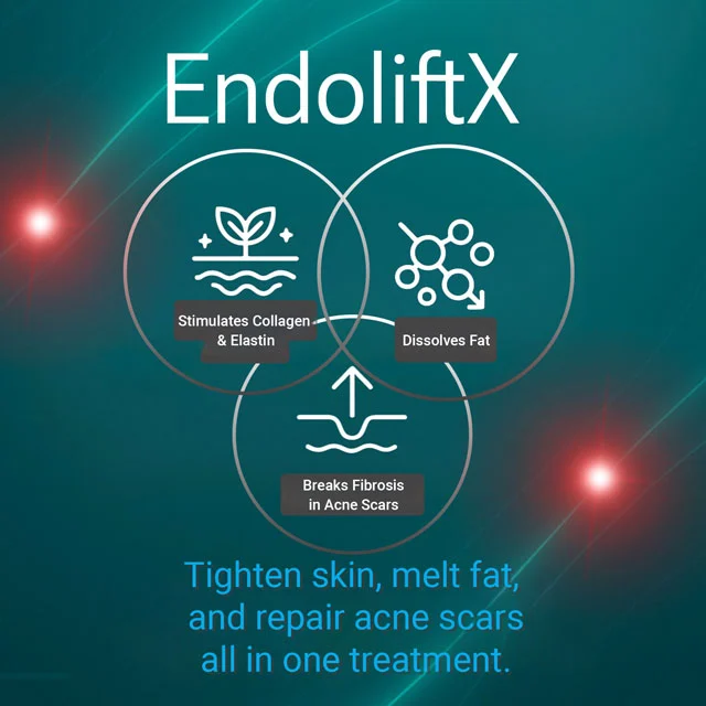 What Endolift X Helps With